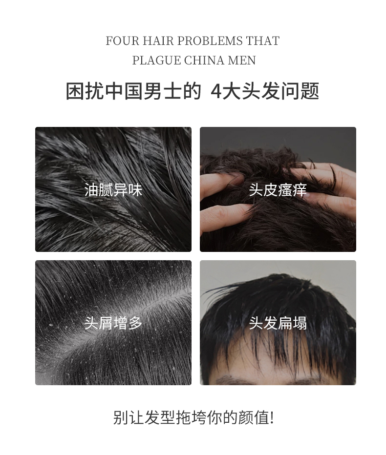 困擾中國男士的四大問題，油膩異味、頭皮瘙癢、頭屑增多、頭發扁塌